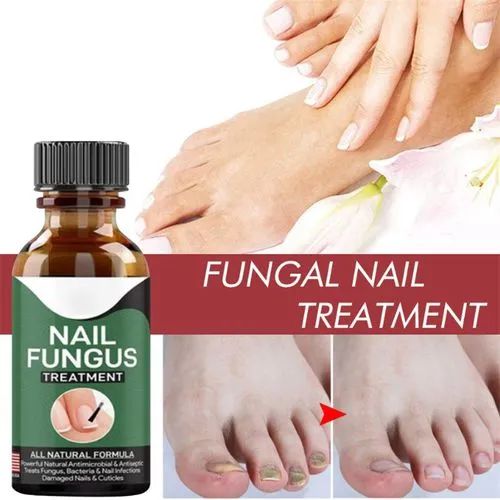 Fast Nail Fungus Treatment Serum