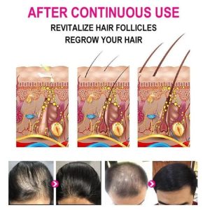 Anti-Grey Hair Serum – Hair Darkening